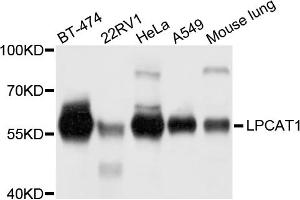 Western blot analysis of extracts of various cell lines, using LPCAT1 antibody (ABIN5972886) at 1/1000 dilution. (LPCAT1 anticorps)