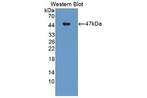 Detection of Recombinant WT1, Human using Polyclonal Antibody to Wilms Tumor Protein (WT1) (WT1 anticorps  (AA 310-446))