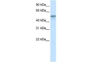 WB Suggested Anti-FOXO3A Antibody Titration:  0. (FOXO3 anticorps  (C-Term))