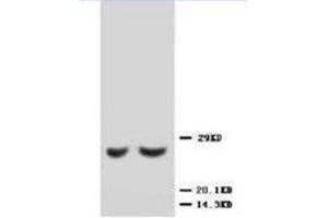 Western blot analysis of rat kidney lysis using TIMP2 antibody (TIMP2 anticorps  (C-Term))