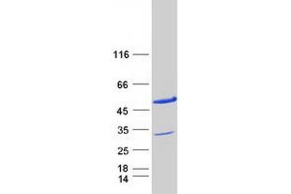 PDCD2L Protein (Myc-DYKDDDDK Tag)