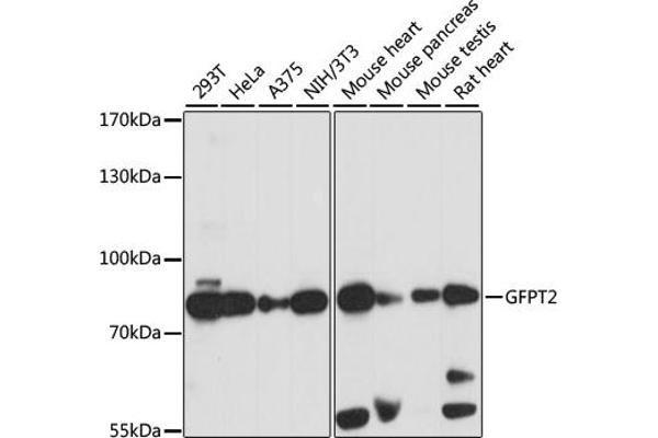 GFPT2 anticorps  (AA 200-260)