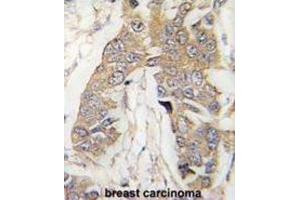 Immunohistochemistry (IHC) image for anti-Cancer Susceptibility Candidate 3 (CASC3) antibody (ABIN3003095) (CASC3 anticorps)