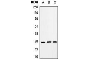 Western blot analysis of RAB33A expression in HEK293T (A), Raw264. (RAB33A anticorps  (Center))