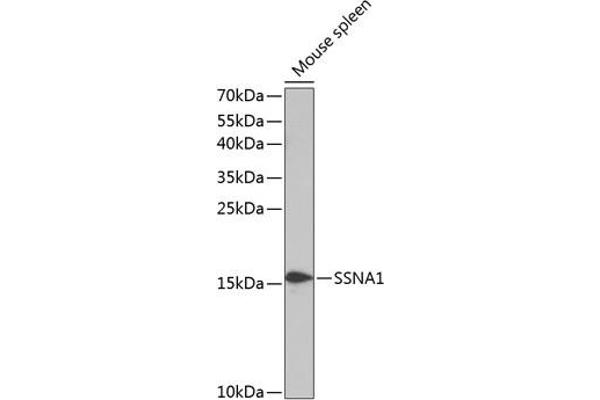 SSNA1 anticorps  (AA 1-119)