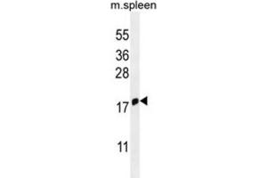 Western Blotting (WB) image for anti-Interferon Induced Transmembrane Protein 5 (IFITM5) antibody (ABIN2995993) (IFITM5 anticorps)