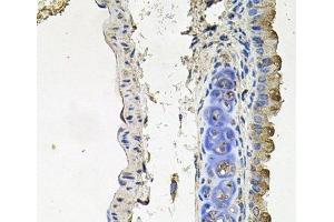 Immunohistochemistry of paraffin-embedded Mouse lung using NDUFA6 Polyclonal Antibody at dilution of 1:100 (40x lens). (NDUFA6 anticorps)