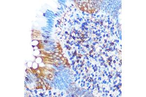 Immunohistochemistry of paraffin-embedded human appendix using PG Rabbit mAb (ABIN1679556, ABIN3018645, ABIN3018646 and ABIN7101637) at dilution of 1:100 (40x lens). (PGAM1 anticorps)