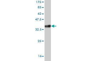 Western Blot detection against Immunogen (34. (HAND2 anticorps  (AA 135-216))