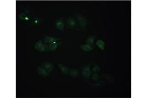 Staining of methanol-fixed Hela cells by Immunocytochemistry using Mouse anti-Human beta 2 Microglobulin monoclonal antibody (D2E9) at 1/50 (20 µg/ml). (beta-2 Microglobulin anticorps)