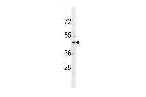 Western blot analysis in HL-60 cell line lysates (35ug/lane). (CHST10 anticorps  (C-Term))