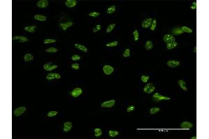 Immunofluorescence of purified MaxPab antibody to NCL on HeLa cell. (Nucleolin anticorps  (AA 1-710))