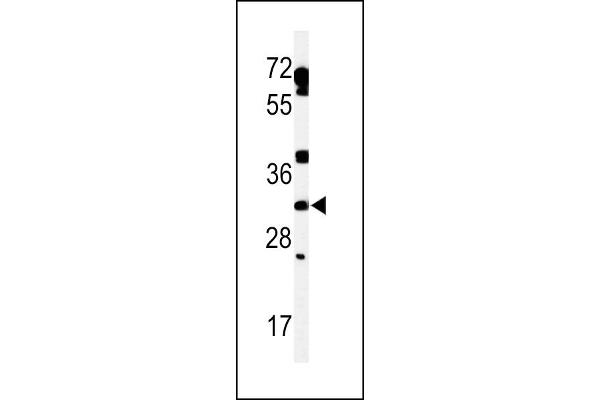 TBC1D7 anticorps  (AA 150-179)