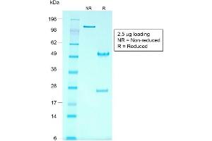 SDS-PAGE Analysis of Purified GPC3 Mouse Recombinant Monoclonal Antibody ABIN6383809. (Recombinant Glypican 3 anticorps)