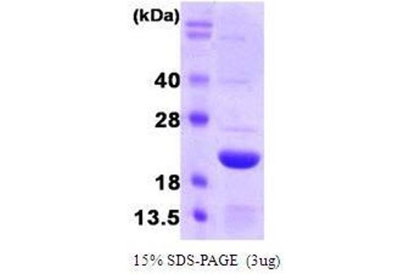 FTL Protein (AA 1-175)