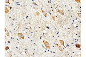 Anti-Dopamine Receptor D3 antibody, IHC(P) IHC(P): Rat Brain Tissue (DRD3 anticorps  (C-Term))