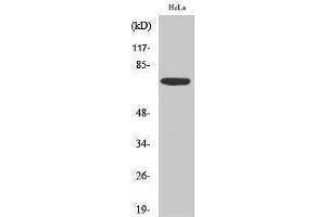 Western Blotting (WB) image for anti-Eukaryotic Translation Initiation Factor 2-alpha Kinase 2 (EIF2AK2) (Thr392) antibody (ABIN3186490) (EIF2AK2 anticorps  (Thr392))