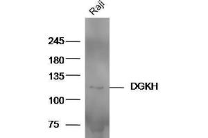 Raji cell lysates probed with Anti-DGKH Polyclonal Antibody  at 1:5000 90min in 37˚C. (DGKH anticorps  (AA 51-150))
