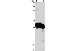Western Blotting (WB) image for anti-Ketohexokinase (KHK) antibody (ABIN2429498) (Ketohexokinase anticorps)