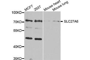 Western blot analysis of extracts of various cell lines, using SLC27A6 antibody (ABIN5974523) at 1/1000 dilution. (SLC27A6 anticorps)