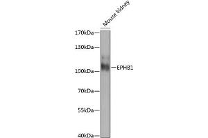 Western blot analysis of extracts of mouse kidney, using EPHB1 antibody (ABIN6131628, ABIN6140221, ABIN6140222 and ABIN6224469) at 1:1000 dilution. (EPH Receptor B1 anticorps  (AA 260-500))