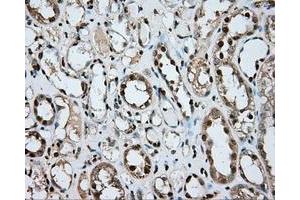 Immunohistochemical staining of paraffin-embedded liver tissue using anti-ERCC1 mouse monoclonal antibody. (ERCC1 anticorps)