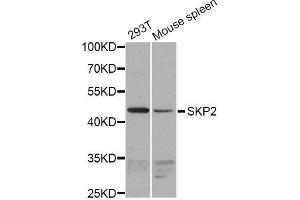 Western blot analysis of extracts of various cell lines, using SKP2 antibody (ABIN5995995) at 1/1000 dilution. (SKP2 anticorps)