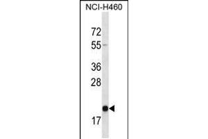 Western blot analysis in NCI-H460 cell line lysates (35ug/lane). (TMED2 anticorps  (N-Term))
