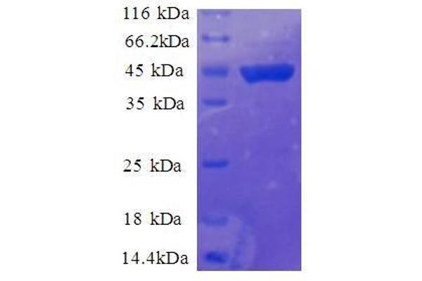 RPS11 Protein (AA 2-158, full length) (GST tag)