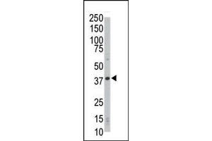 Western blot analysis of anti-CDK4 Pab in HL-60 cell lysate. (CDK4 anticorps  (C-Term))