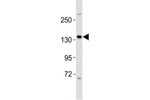 Western blot testing of ERBB4 antibody at 1:2000 dilution + MCF-7 lysate; Predicted molecular weight: 147-180 kDa (precursor), 120, 80 kDa (cleaved forms). (ERBB4 anticorps  (AA 1141-1166))