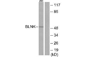 Immunohistochemistry analysis of paraffin-embedded human tonsil tissue using BLNK (Ab-96) antibody. (B-Cell Linker anticorps)