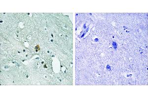 P-peptide - +Immunohistochemistry analysis of paraffin-embedded human brain tissue using IP3R1 (Phospho-Ser1764) antibody. (ITPR1 anticorps  (pSer1764))
