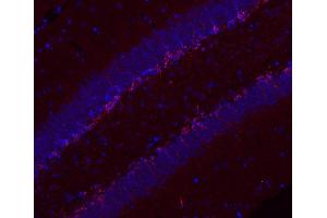 Indirect immunostaining of paraffin embedded PFA fixed mouse hippocampus section (1 : 200; red). (Doublecortin anticorps)