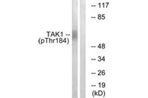 Western blot analysis of extracts from HepG2 cells treated with TNF 20ng/ml 5', using TAK1 (Phospho-Thr184) Antibody. (TR4 anticorps  (pThr184))