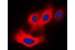 Immunofluorescent analysis of PAK4 (pS474) staining in Raw264. (PAK4 anticorps  (C-Term, pSer474))