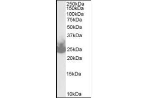 Image no. 1 for anti-Synaptosomal-Associated Protein, 25kDa (SNAP25) (C-Term) antibody (ABIN372760) (SNAP25 anticorps  (C-Term))