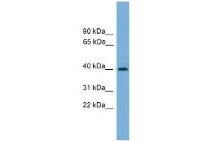 WB Suggested Anti-SERPINB8 Antibody Titration: 0. (SERPINB8 anticorps  (Middle Region))