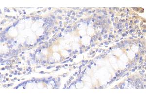 Detection of SNX9 in Human Colon Tissue using Polyclonal Antibody to Sorting Nexin 9 (SNX9) (SNX9 anticorps  (AA 250-595))
