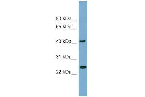 WB Suggested Anti-FLJ25439 Antibody Titration: 0. (TTC23L anticorps  (N-Term))