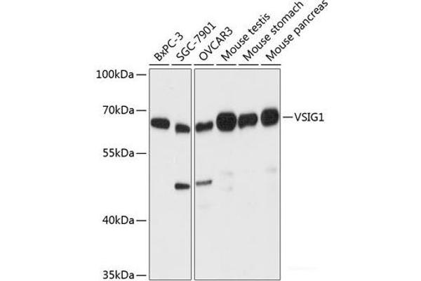 VSIG1 anticorps