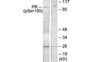 Western Blotting (WB) image for anti-Progesterone Receptor (PGR) (pSer190) antibody (ABIN2888516) (Progesterone Receptor anticorps  (pSer190))