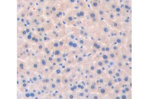 IHC-P analysis of liver tissue, with DAB staining. (TSSK1 anticorps  (AA 57-314))