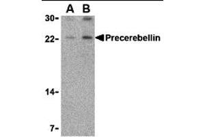 Western Blotting (WB) image for anti-Cerebellin 1 Precursor (CBLN1) (Middle Region) antibody (ABIN1031046) (CBLN1 anticorps  (Middle Region))