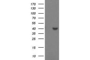 HEK293T cells were transfected with the pCMV6-ENTRY control (Left lane) or pCMV6-ENTRY SULT1C2 (Right lane) cDNA for 48 hrs and lysed. (SULT1C2 anticorps)