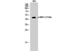 Western Blotting (WB) image for anti-Mitogen-Activated Protein Kinase Kinase 2 (MAP2K2) (pThr394) antibody (ABIN3179468) (MEK2 anticorps  (pThr394))