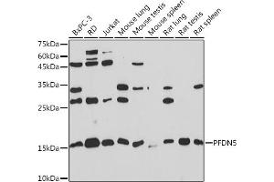Western blot analysis of extracts of various cell lines, using PFDN5 Rabbit mAb (ABIN1682853, ABIN3018535, ABIN3018536 and ABIN7101624) at 1:1000 dilution. (PFDN5 anticorps)