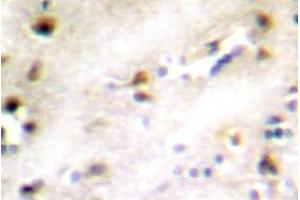 Image no. 2 for anti-ZFP36 Ring Finger Protein-Like 1 (ZFP36L1) antibody (ABIN317801) (ZFP36L1 anticorps)