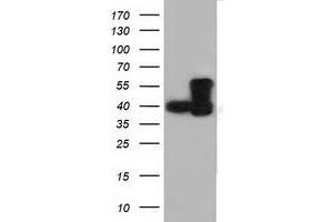 HEK293T cells were transfected with the pCMV6-ENTRY control (Left lane) or pCMV6-ENTRY DYNC1LI1 (Right lane) cDNA for 48 hrs and lysed. (DYNC1LI1 anticorps)