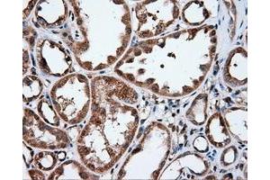 Immunohistochemical staining of paraffin-embedded liver tissue using anti-IFIT1 mouse monoclonal antibody. (IFIT1 anticorps)